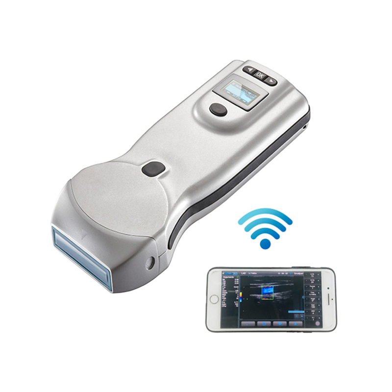 무선 휴대용 컬러 도플러 초음파 의료 장비